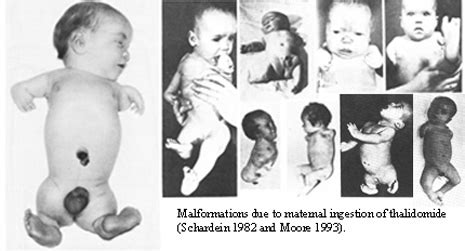 thalidomide gene effects